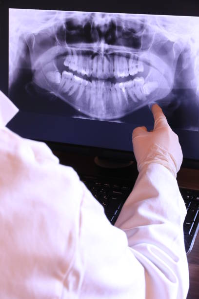 Best Emergency Dental Care for Broken or Chipped Teeth in Hobe Sound, FL