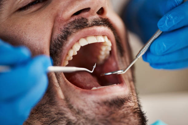 Best Emergency Treatment for Dental Infections or Abscesses in Hobe Sound, FL